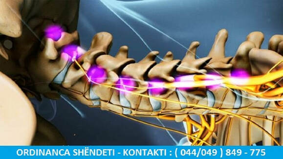 Shkaqet dhe Trajtimi i Osteoartritit të Qafës